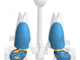 液压后盖凝固模拟